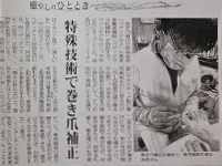 注目の巻き爪補正